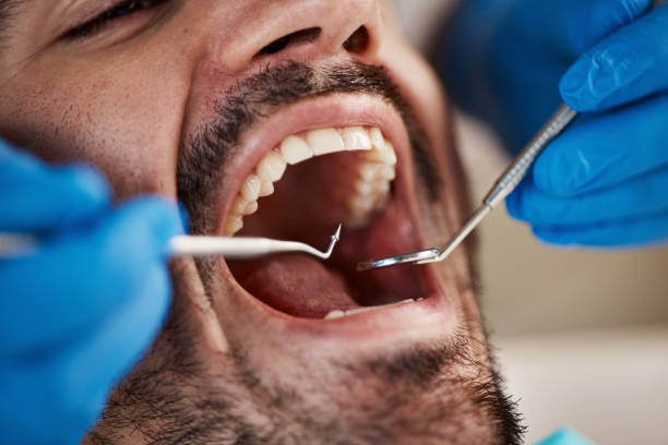 Best Emergency Denture Repair in Englewood, OH